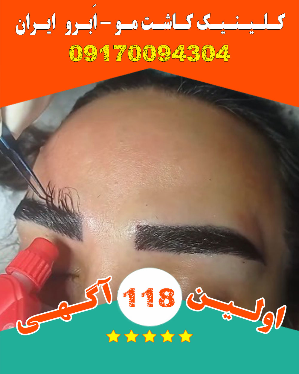 کلینیک کاشت مو ، اَبرو ایران در بیرجند دکتر رستمی